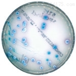 Chromogenic Petri dish